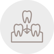 Corticobasal DONCEL